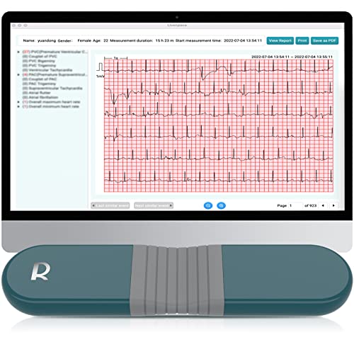 AI HR Monitor: Your 24-Hour Heart Health Companion!